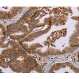 Immunohistochemistry - MFAP5 Antibody from Signalway Antibody (37713) - Antibodies.com