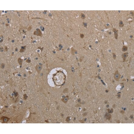 Immunohistochemistry - MARK4 Antibody from Signalway Antibody (37716) - Antibodies.com