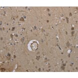 Immunohistochemistry - MARK4 Antibody from Signalway Antibody (37716) - Antibodies.com