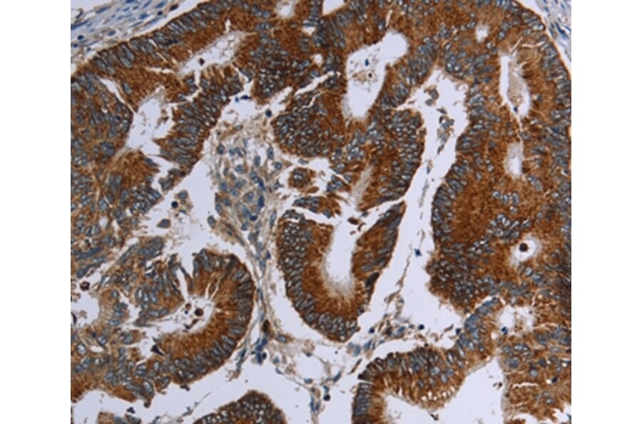 Immunohistochemistry - MDFIC Antibody from Signalway Antibody (37721) - Antibodies.com