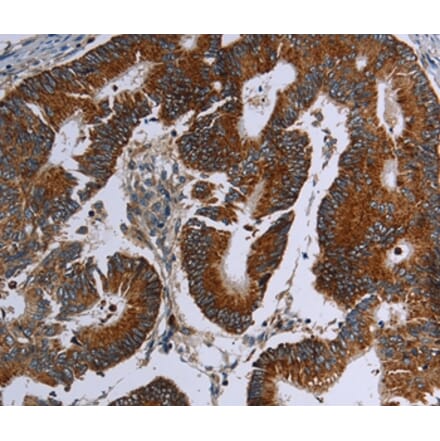 Immunohistochemistry - MDFIC Antibody from Signalway Antibody (37721) - Antibodies.com