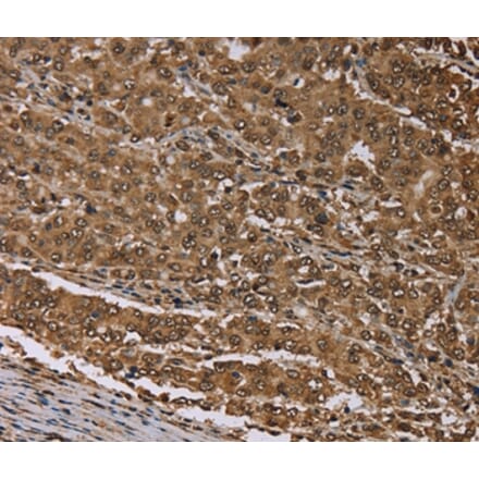 Immunohistochemistry - MEIS1 Antibody from Signalway Antibody (37722) - Antibodies.com