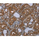 Immunohistochemistry - MEIS1 Antibody from Signalway Antibody (37722) - Antibodies.com