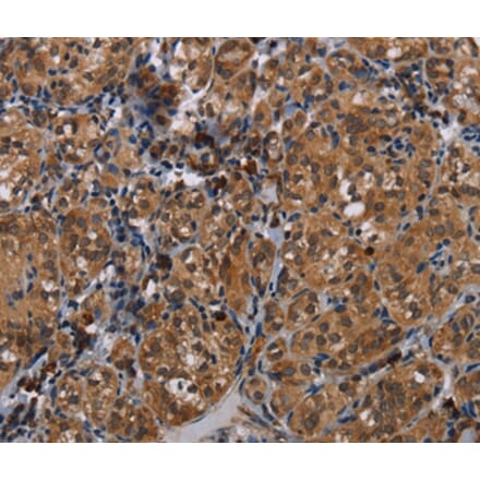 Immunohistochemistry - TRPV1 Antibody from Signalway Antibody (37726) - Antibodies.com
