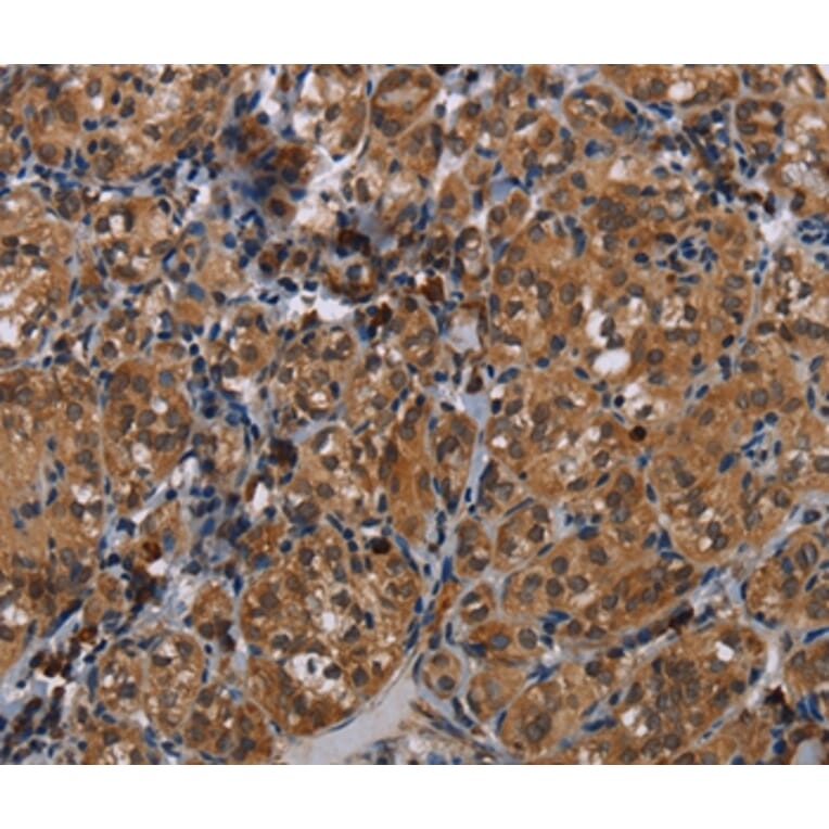 Immunohistochemistry - TRPV1 Antibody from Signalway Antibody (37726) - Antibodies.com