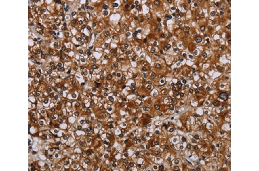Immunohistochemistry - TRPV1 Antibody from Signalway Antibody (37726) - Antibodies.com