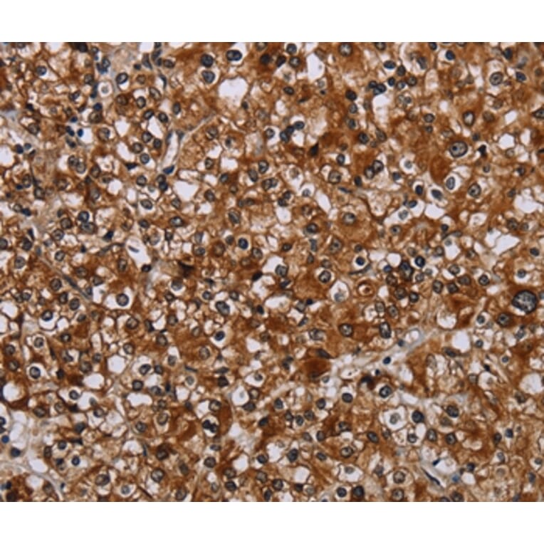 Immunohistochemistry - TRPV1 Antibody from Signalway Antibody (37726) - Antibodies.com