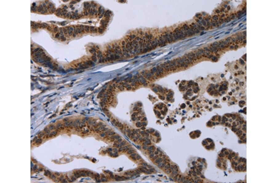 Immunohistochemistry - REG3A Antibody from Signalway Antibody (37727) - Antibodies.com