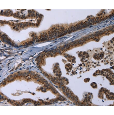 Immunohistochemistry - REG3A Antibody from Signalway Antibody (37727) - Antibodies.com