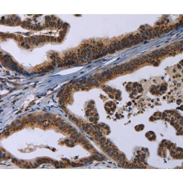 Immunohistochemistry - REG3A Antibody from Signalway Antibody (37727) - Antibodies.com