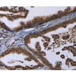 Immunohistochemistry - REG3A Antibody from Signalway Antibody (37727) - Antibodies.com