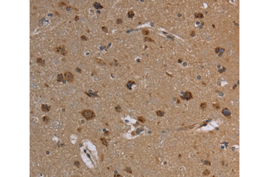 Immunohistochemistry - REG3A Antibody from Signalway Antibody (37727) - Antibodies.com