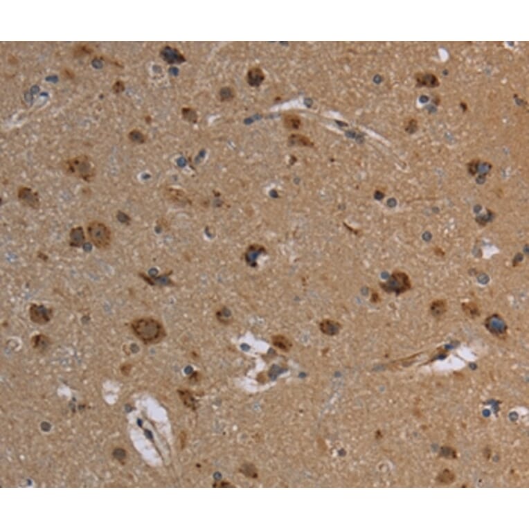 Immunohistochemistry - REG3A Antibody from Signalway Antibody (37727) - Antibodies.com