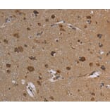 Immunohistochemistry - REG3A Antibody from Signalway Antibody (37727) - Antibodies.com