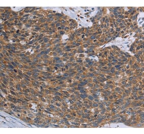 Immunohistochemistry - TNPO1 Antibody from Signalway Antibody (37732) - Antibodies.com