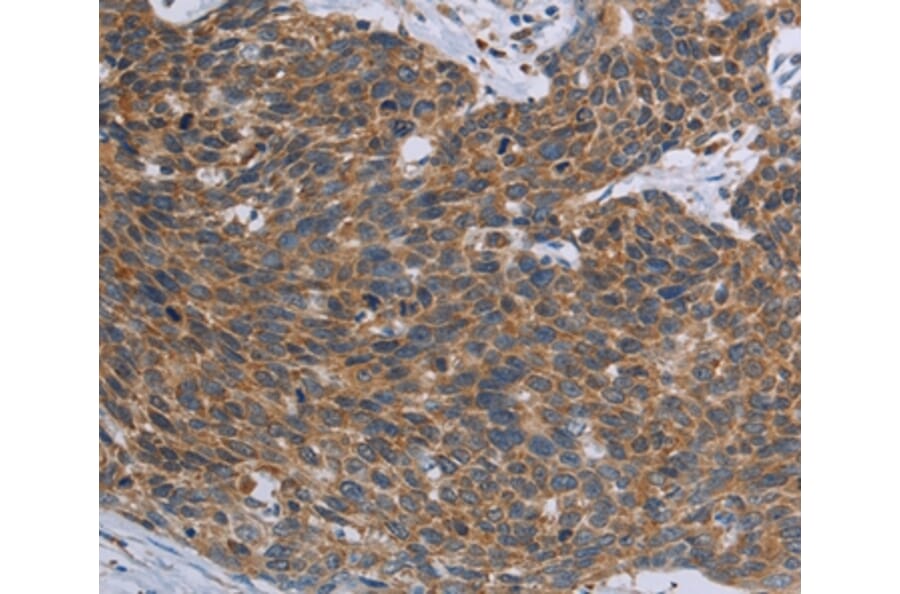 Immunohistochemistry - TNPO1 Antibody from Signalway Antibody (37732) - Antibodies.com