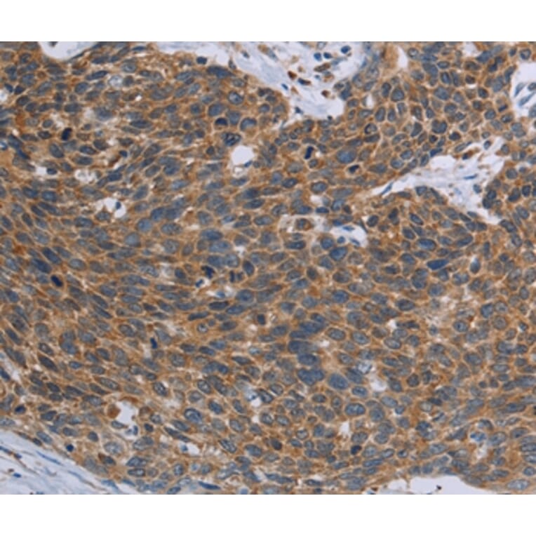 Immunohistochemistry - TNPO1 Antibody from Signalway Antibody (37732) - Antibodies.com