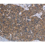 Immunohistochemistry - TNPO1 Antibody from Signalway Antibody (37732) - Antibodies.com