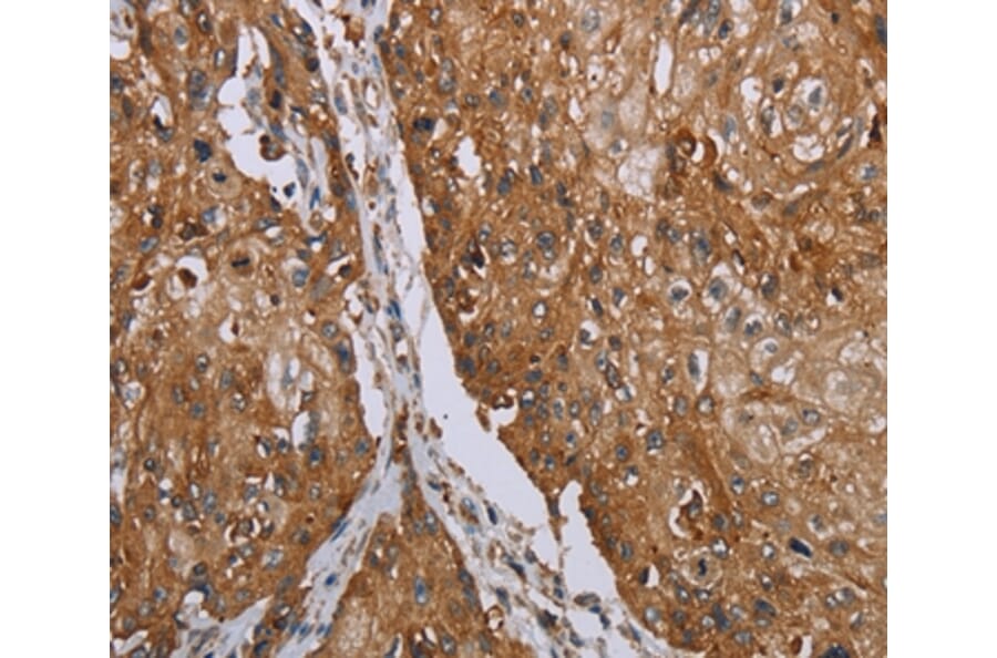 Immunohistochemistry - TNPO1 Antibody from Signalway Antibody (37732) - Antibodies.com