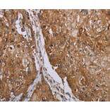 Immunohistochemistry - TNPO1 Antibody from Signalway Antibody (37732) - Antibodies.com