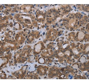 Immunohistochemistry - MTSS1 Antibody from Signalway Antibody (37744) - Antibodies.com