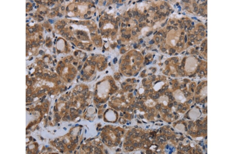 Immunohistochemistry - MTSS1 Antibody from Signalway Antibody (37744) - Antibodies.com