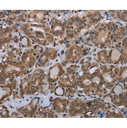 Immunohistochemistry - MTSS1 Antibody from Signalway Antibody (37744) - Antibodies.com