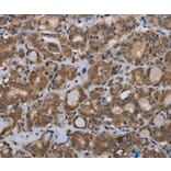 Immunohistochemistry - MTSS1 Antibody from Signalway Antibody (37744) - Antibodies.com