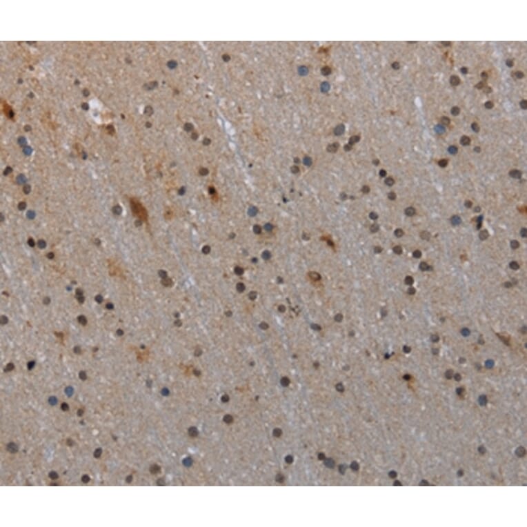 Immunohistochemistry - MTSS1 Antibody from Signalway Antibody (37744) - Antibodies.com