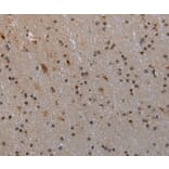 Immunohistochemistry - MTSS1 Antibody from Signalway Antibody (37744) - Antibodies.com