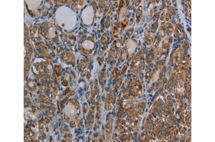 Immunohistochemistry - MYO7A Antibody from Signalway Antibody (37747) - Antibodies.com