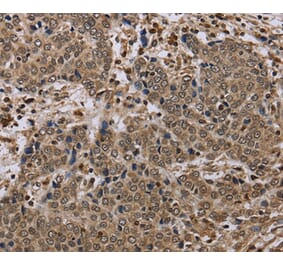 Immunohistochemistry - NLRP4 Antibody from Signalway Antibody (37751) - Antibodies.com