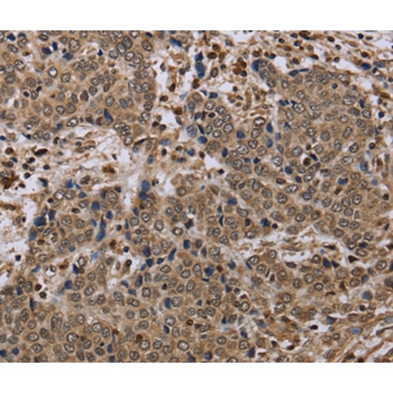Immunohistochemistry - NLRP4 Antibody from Signalway Antibody (37751) - Antibodies.com