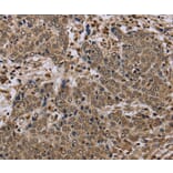 Immunohistochemistry - NLRP4 Antibody from Signalway Antibody (37751) - Antibodies.com