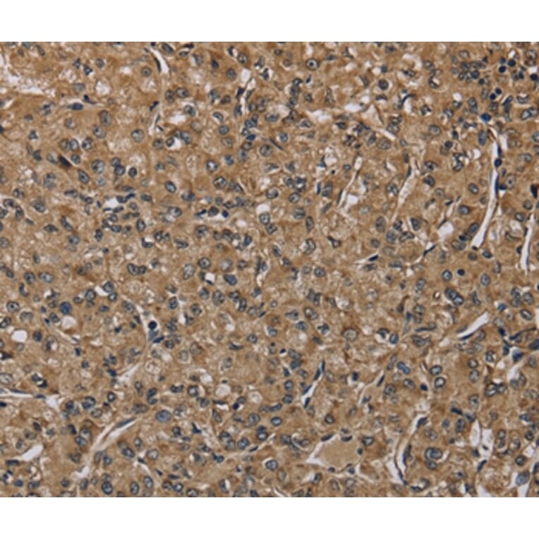 Immunohistochemistry - NLRP4 Antibody from Signalway Antibody (37751) - Antibodies.com