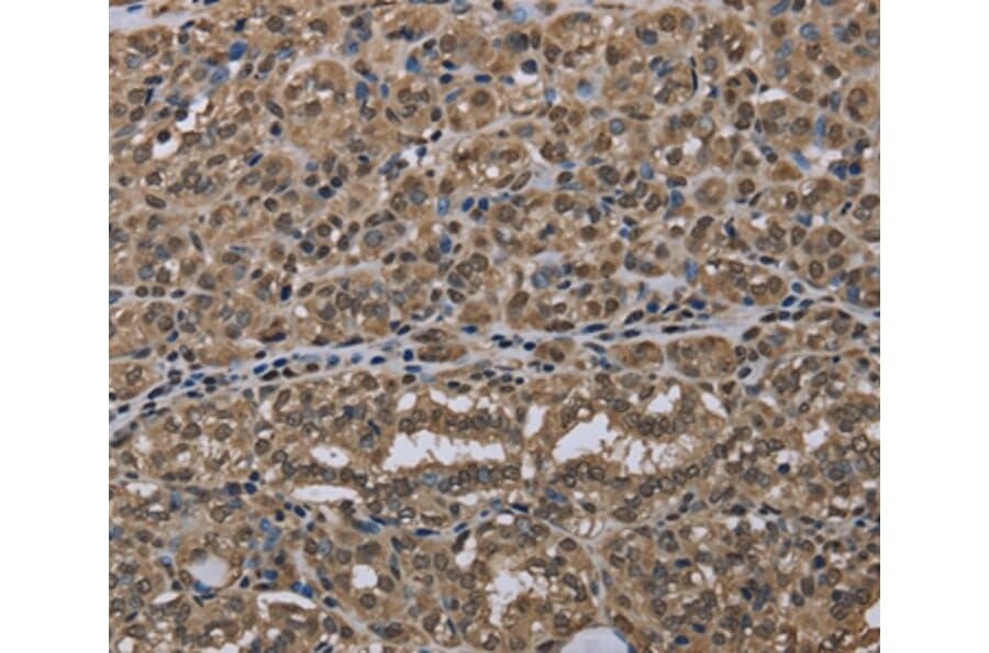 Immunohistochemistry - NLRP6 Antibody from Signalway Antibody (37752) - Antibodies.com