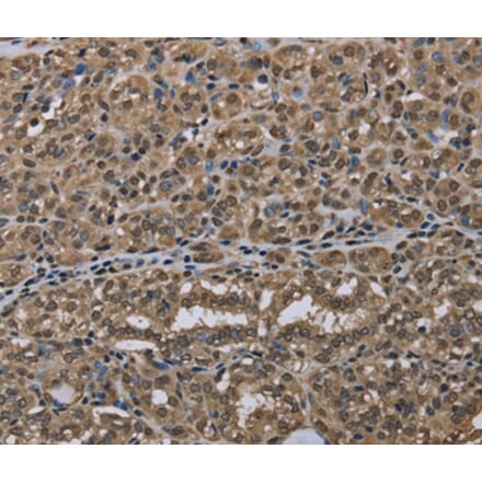 Immunohistochemistry - NLRP6 Antibody from Signalway Antibody (37752) - Antibodies.com