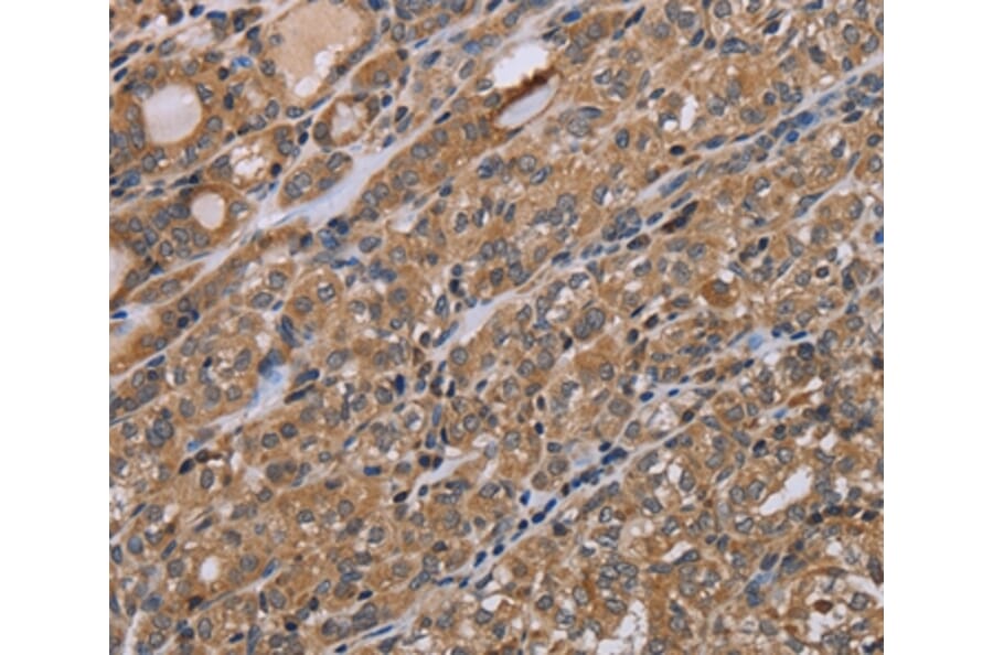 Immunohistochemistry - NAA25 Antibody from Signalway Antibody (37753) - Antibodies.com