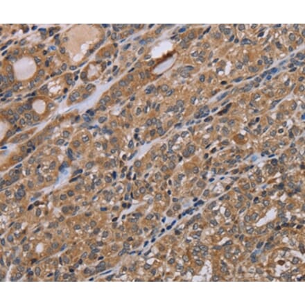Immunohistochemistry - NAA25 Antibody from Signalway Antibody (37753) - Antibodies.com