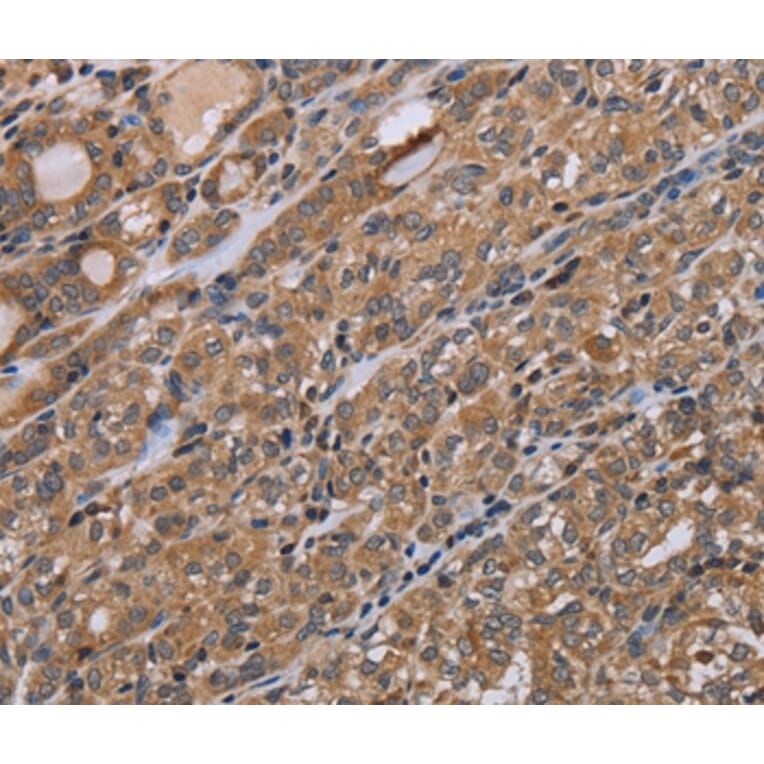 Immunohistochemistry - NAA25 Antibody from Signalway Antibody (37753) - Antibodies.com
