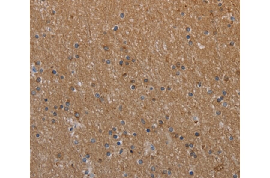 Immunohistochemistry - NAA25 Antibody from Signalway Antibody (37753) - Antibodies.com