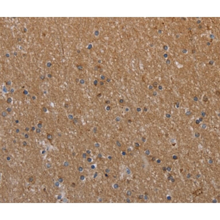 Immunohistochemistry - NAA25 Antibody from Signalway Antibody (37753) - Antibodies.com