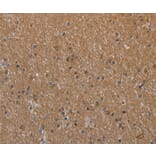 Immunohistochemistry - NAA25 Antibody from Signalway Antibody (37753) - Antibodies.com