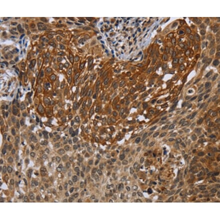 Immunohistochemistry - UHRF2 Antibody from Signalway Antibody (37761) - Antibodies.com