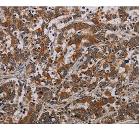 Immunohistochemistry - NLRP9 Antibody from Signalway Antibody (37768) - Antibodies.com