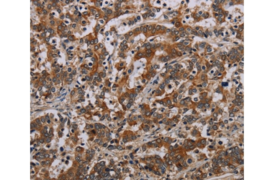 Immunohistochemistry - NLRP9 Antibody from Signalway Antibody (37768) - Antibodies.com