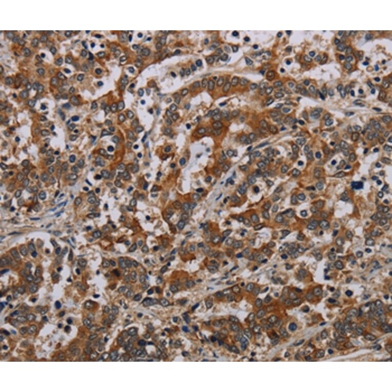 Immunohistochemistry - NLRP9 Antibody from Signalway Antibody (37768) - Antibodies.com