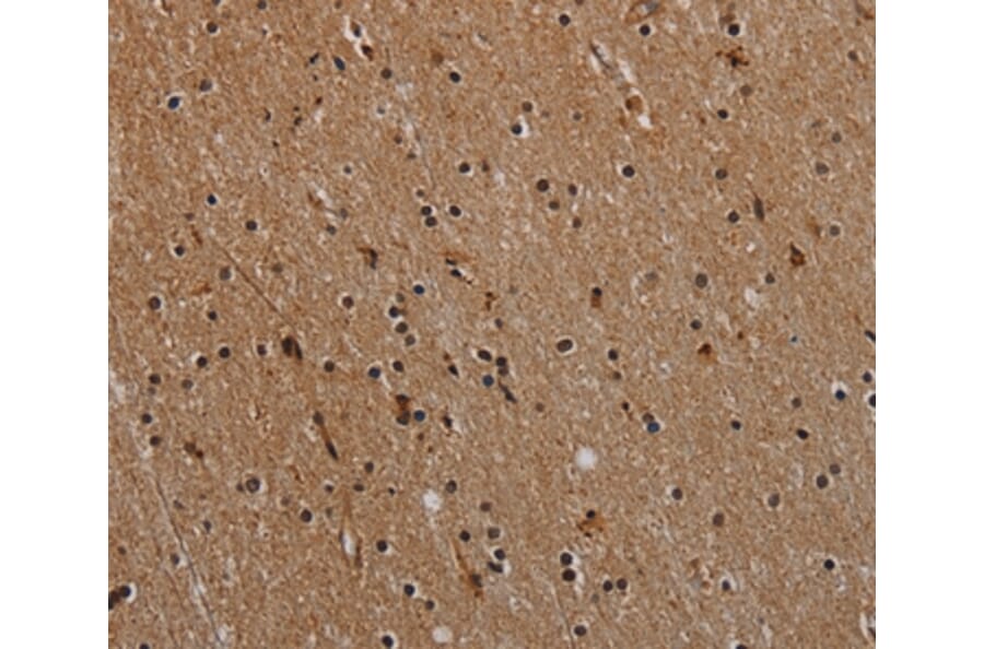 Immunohistochemistry - NLRP9 Antibody from Signalway Antibody (37768) - Antibodies.com