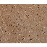 Immunohistochemistry - NLRP9 Antibody from Signalway Antibody (37768) - Antibodies.com