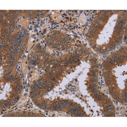 Immunohistochemistry - NPTX1 Antibody from Signalway Antibody (37776) - Antibodies.com
